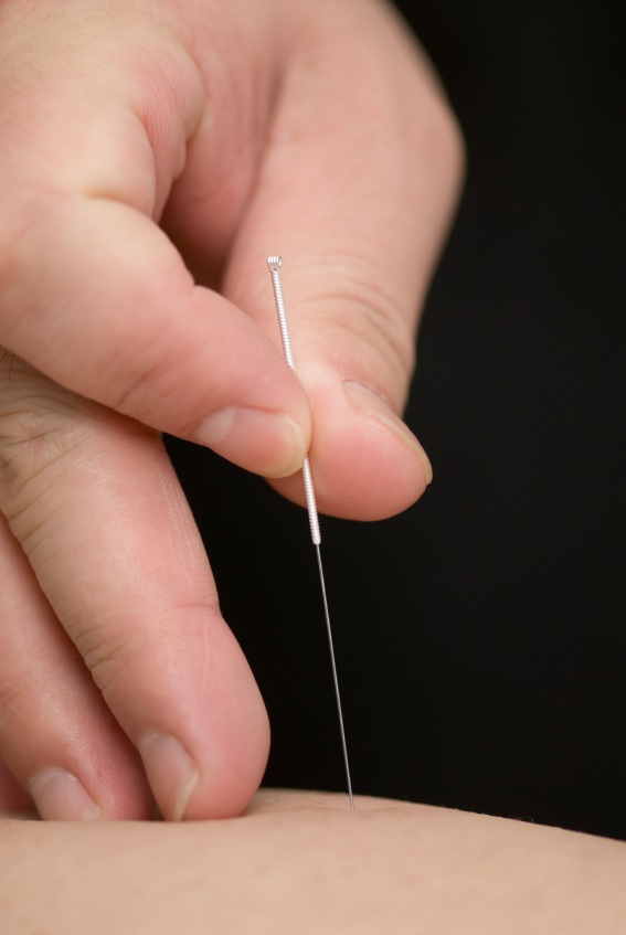 L'acupuncture accompagne la grossesse - Maternité d'Orsay
